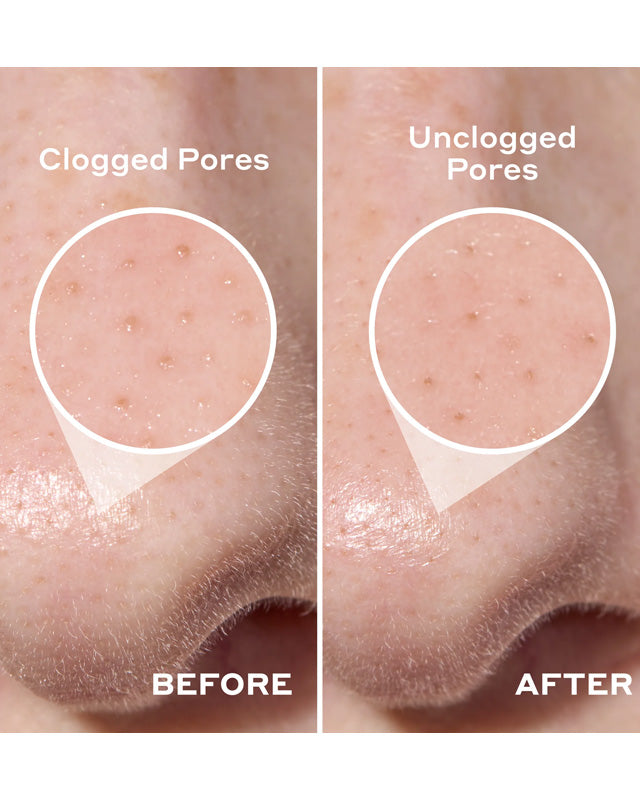 雙效深層潔淨毛孔貼