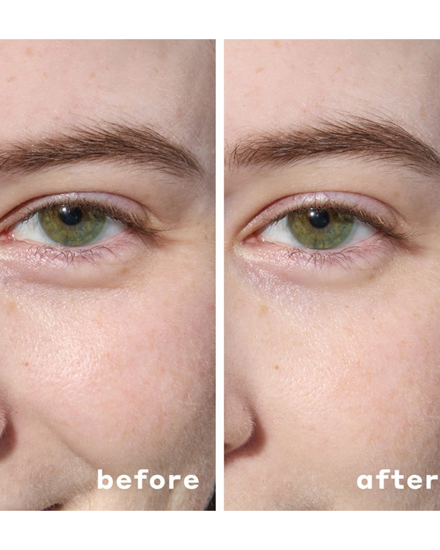 Hydrogel Under Eye Patches