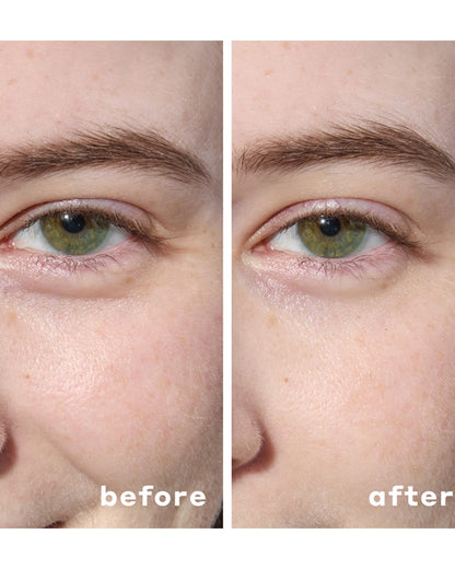 Hydrogel Under Eye Patches