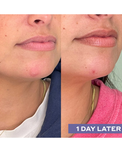 Repairing Facial Spray with Hypochlorous Acid