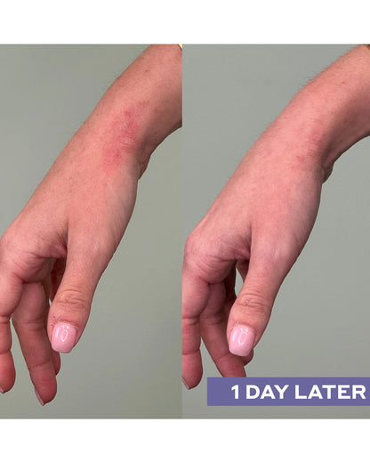 Repairing Facial Spray with Hypochlorous Acid