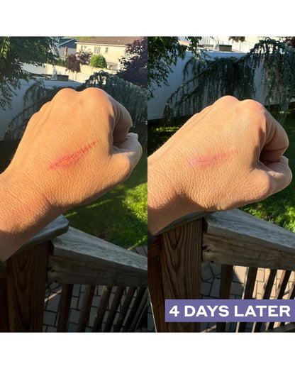 Repairing Facial Spray with Hypochlorous Acid